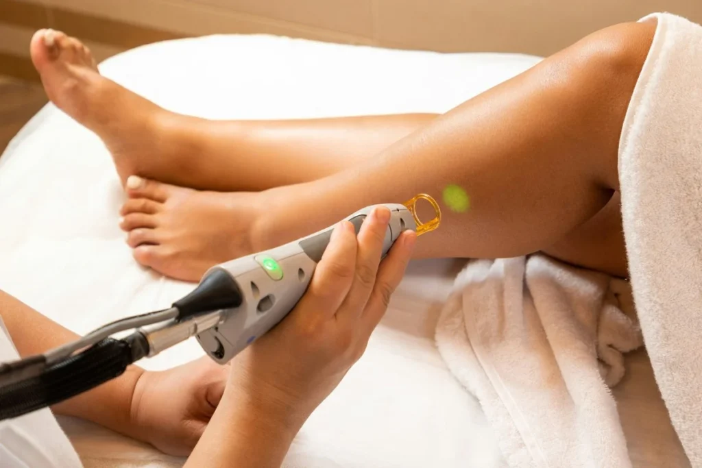 Laser hair removal treatment on a leg with green laser light